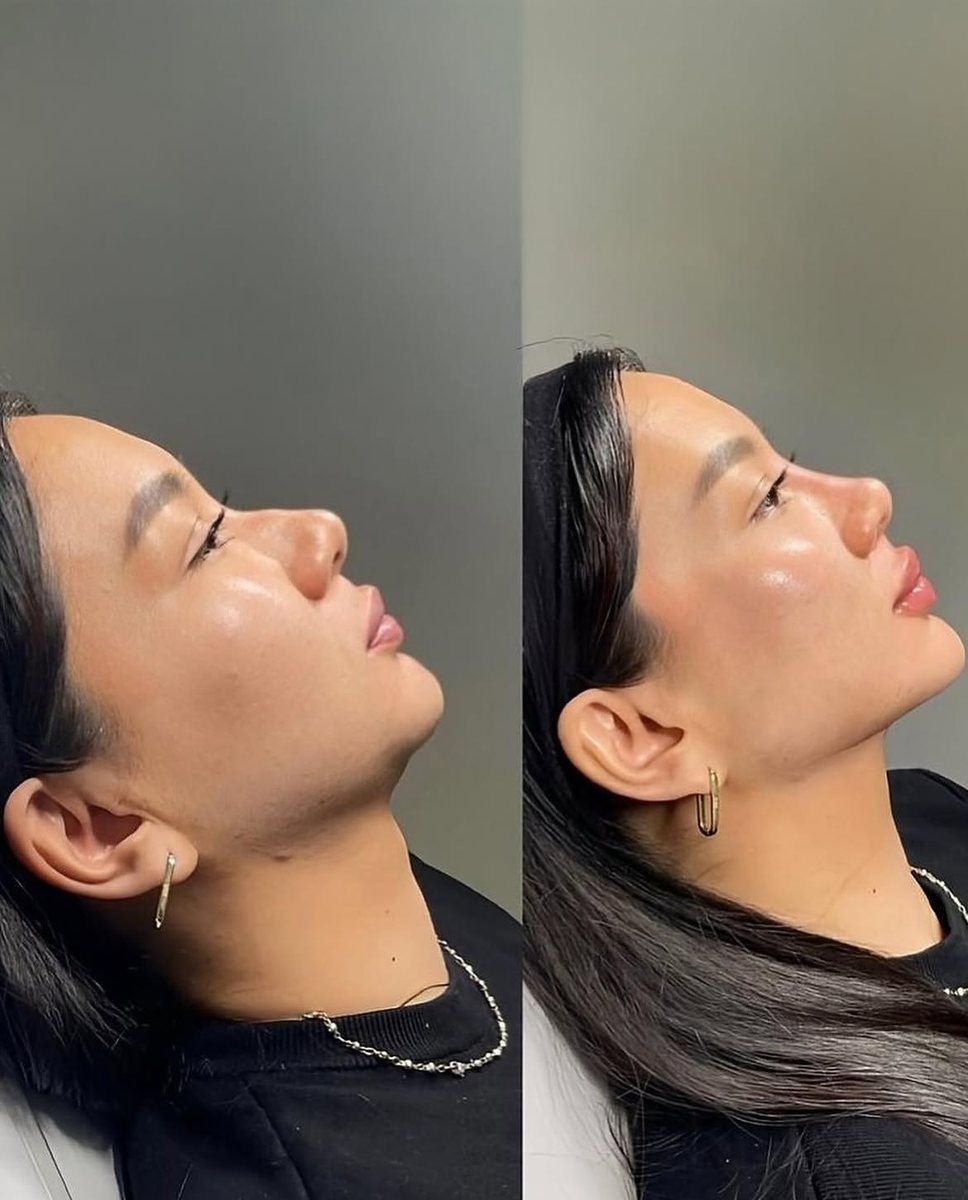 Full Face